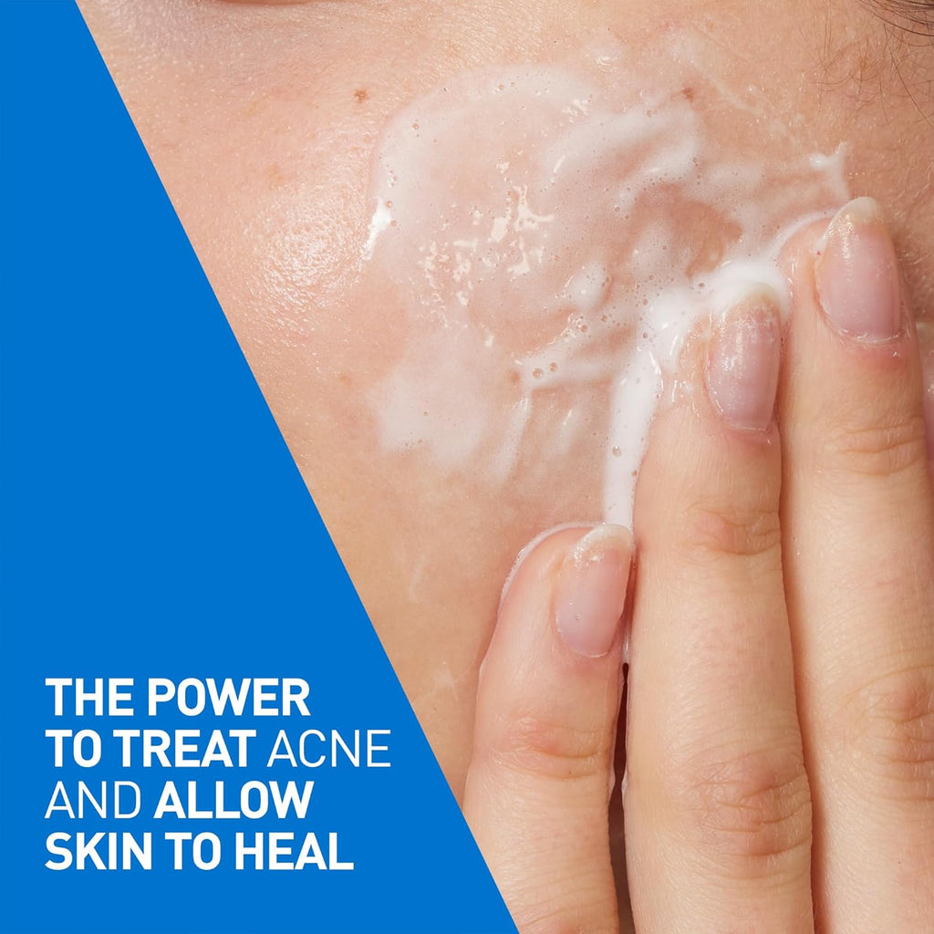 4% Benzoyl Peroxide Acne Treatment Foaming Cleanser Face & Body Wash, with Hyaluronic Acid and Niacinamide. Helps Clear Acne Pimples and Prevent Breakouts. Gentle Gel, Fragrance-Free, 150ML